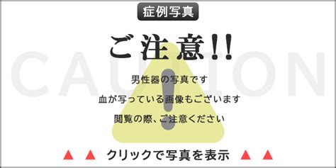 亀頭増大 銀座|亀頭増大術について